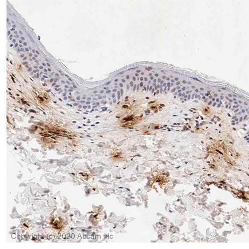 29211. ANTI-MAST CELL TRYPTASE ANTIBODY (AA1) 100UL ABCAM