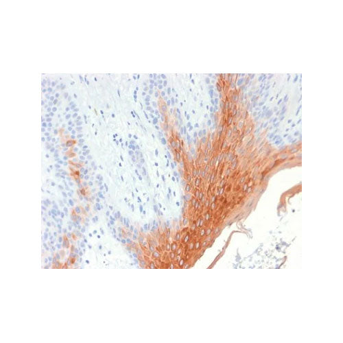 29913. RECOMBINANT ANTI-CYTOKERATIN 10 ANTIBODY (KRT10/1990R) 100UG ABCAM