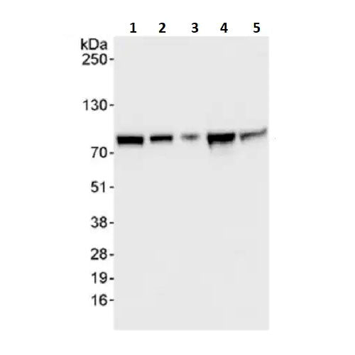 27933. ANTI-APP-1 ANTIBODY 20UG ABCAM