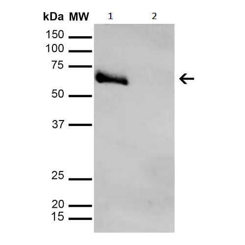 28796. ANTI-METHYLGLYOXAL ANTIBODY (9F11) 100UG ABCAM