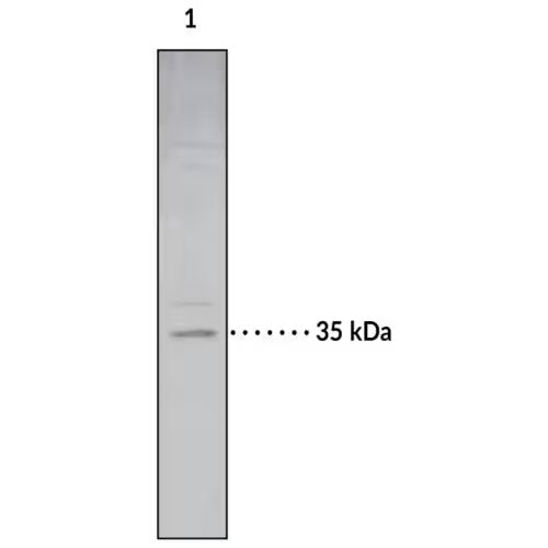 29181. ANTI-MONOACYLGLYCEROL LIPASE/MGL ANTIBODY 300UG ABCAM