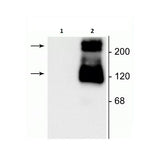 27936. ANTI-MGLUR1 ANTIBODY 100UL ABCAM