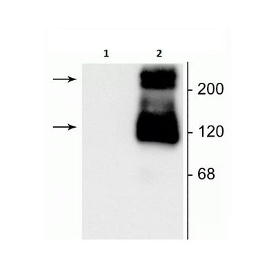 27936. ANTI-MGLUR1 ANTIBODY 100UL ABCAM