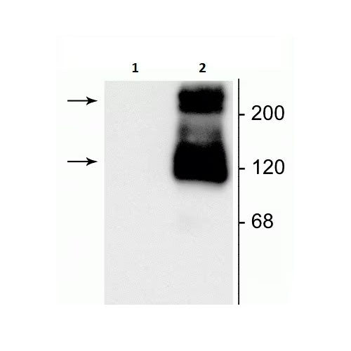 27936. ANTI-MGLUR1 ANTIBODY 100UL ABCAM