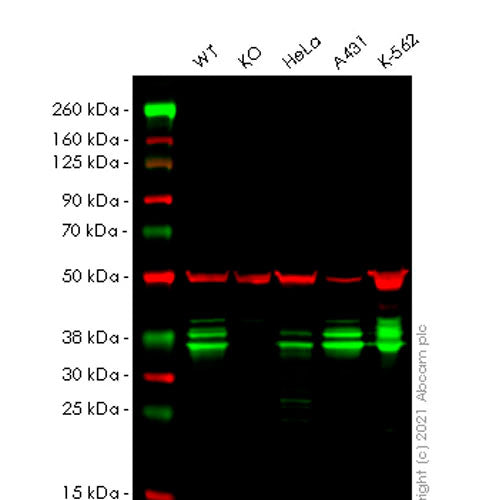 28797. RECOMBINANT ANTI-HNRNP A2B1 ANTIBODY (EPR24002-81) 100UL ABCAM