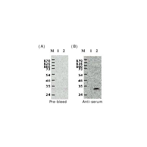 29927. ANTI-WHITE SPOT SYNDROME VIRUS VP28 ANTIBODY 125UL ABCAM