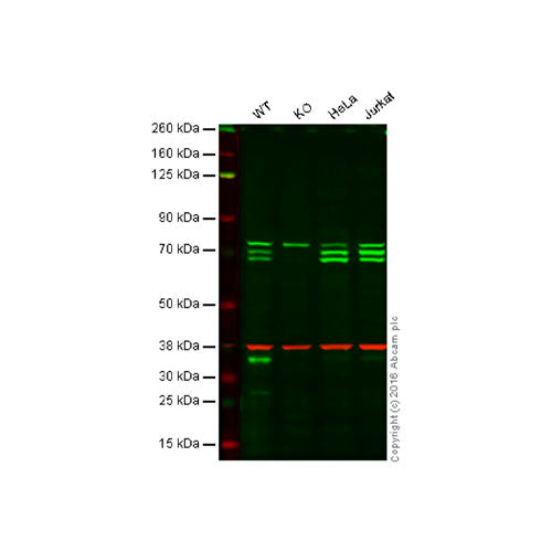 29491. AUTOPHAGY ANALYSIS (ATG16L1 ATG16L1 PS278 SQSTM1 LC3B UBIQUITIN M6PR) ANTIBODY SAMPLER PANEL ABCAM