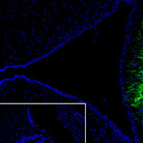 29492. RECOMBINANT ANTI-CRF ANTIBODY (EPR23255-162) 100UL ABCAM