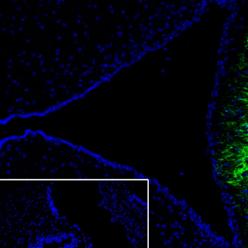 29492. RECOMBINANT ANTI-CRF ANTIBODY (EPR23255-162) 100UL ABCAM