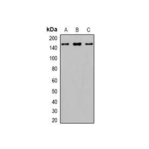 29493. ANTI-GLI1 ANTIBODY 100UL ABCAM