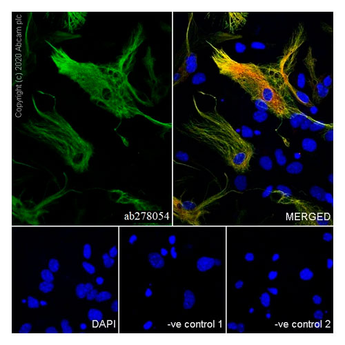 27940. RECOMBINANT ANTI-GFAP ANTIBODY (RM1003) 100UL ABCAM