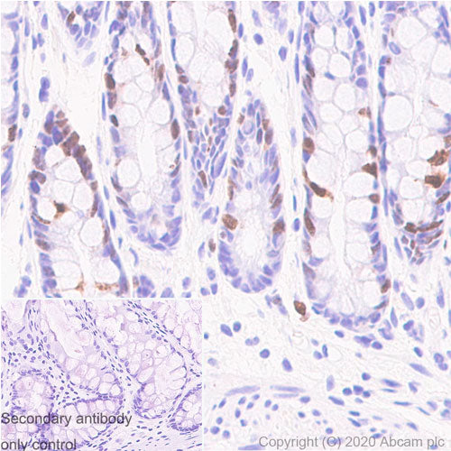 29917. RECOMBINANT ANTI-KI67 ANTIBODY (B56) 100UG ABCAM