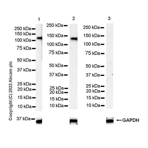 29498. RECOMBINANT ANTI-ENOS ANTIBODY (EPR26335-79) 100UL ABCAM