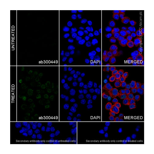 29916. RECOMBINANT ANTI-EGR1 ANTIBODY (EPR23981-46) 100UL ABCAM