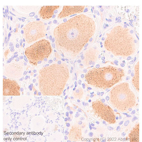 56821. RECOMBINANT ANTI-P2X3 ANTIBODY (EPR26568-3) (BSA AND AZIDE FREE) 100UG ABCAM