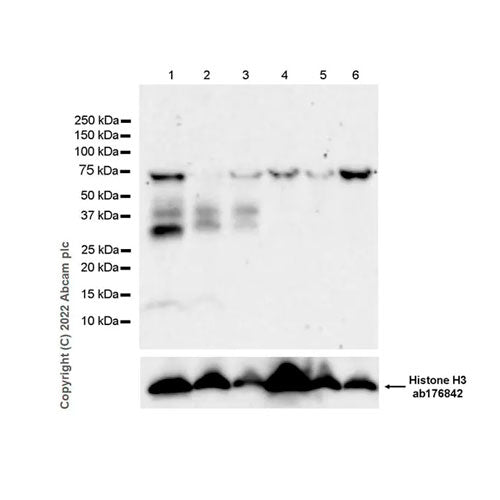 28803. RECOMBINANT ANTI-TREM2 ANTIBODY (EPR26210-1) 100UL ABCAM