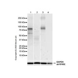 29500. RECOMBINANT ANTI-TRPV1 ANTIBODY 100UL ABCAM