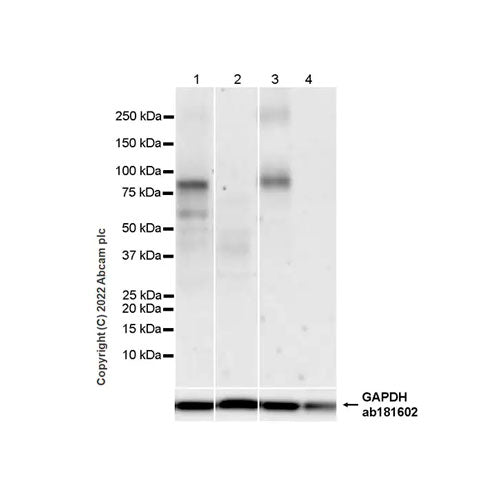 29500. RECOMBINANT ANTI-TRPV1 ANTIBODY 100UL ABCAM