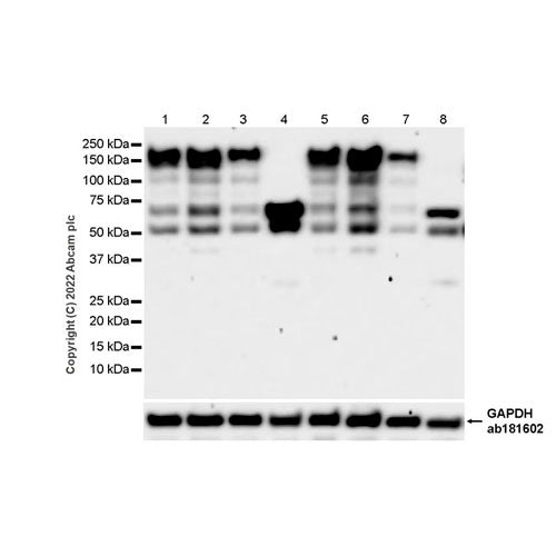 28804. RECOMBINANT ANTI-NNOS (NEURONAL) ANTIBODY (16/NNOS/NOS TYPE I) 100UG ABCAM