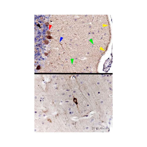 29501. ANTI-NEUROPEPTIDE Y ANTIBODY 100UG ABCAM