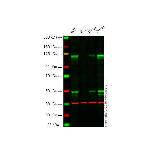 29504. RECOMBINANT ANTI-NFKB P105/P50 ANTIBODY (E381) 100UL ABCAM