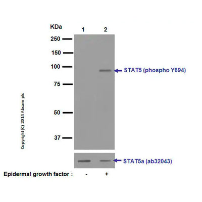 29867. RECOMBINANT ANTI-STAT5 (PHOSPHO Y694) ANTIBODY (E208) 100UL ABCAM