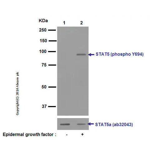 29867. RECOMBINANT ANTI-STAT5 (PHOSPHO Y694) ANTIBODY (E208) 100UL ABCAM