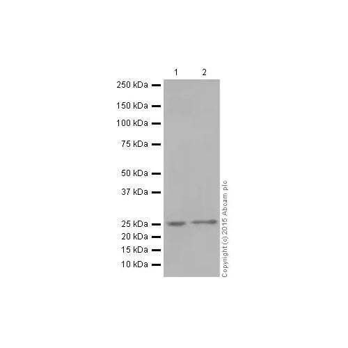 28806. RECOMBINANT ANTI-C REACTIVE PROTEIN ANTIBODY (Y284) 100UL ABCAM