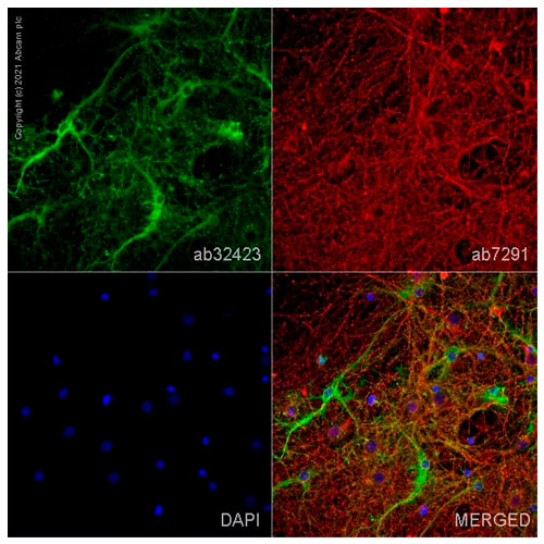 29506. ANTI-BLBP ANTIBODY 100UG ABCAM