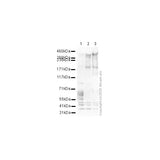 29507. ANTI-MAP2 ANTIBODY-NEUORAL MARKER 100UG ABCAM