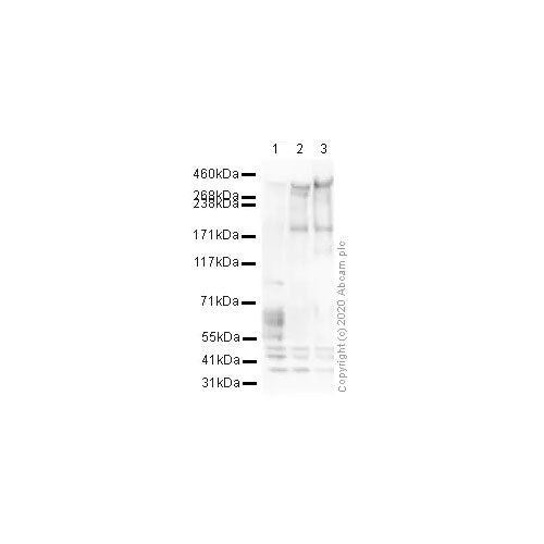 29507. ANTI-MAP2 ANTIBODY-NEUORAL MARKER 100UG ABCAM