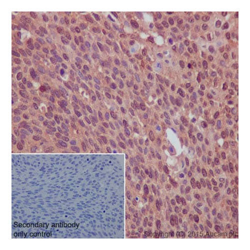 29915. RECOMBINANT ANTI-EGFR ANTIBODY (E114) 100UL ABCAM