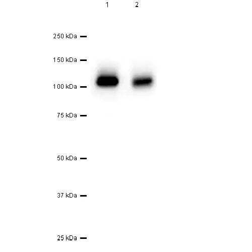 28807. RECOMBINANT ANTI-PDGFR ALPHA + PDGFR BETA ANTIBODY (Y92) 100UL ABCAM