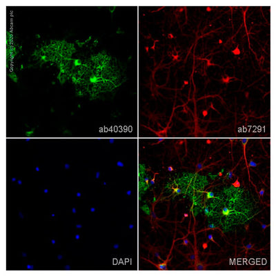 29897. ANTI-MYELIN BASIC PROTEIN ANTIBODY 100UG ABCAM