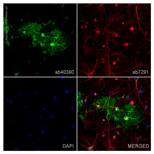 29897. ANTI-MYELIN BASIC PROTEIN ANTIBODY 100UG ABCAM