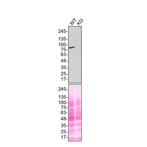 23887. RECOMBINANT ANTI-NAK/TBK1 ANTIBODY (EP611Y) 100UL ABCAM