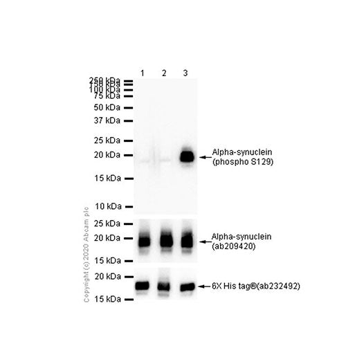 23417. RECOMBINANT ANTI-ALPHA SYNUCLEIN (PHOSPHO S129) ANTIBODY (EP1536Y) 100UL ABCAM