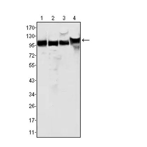 23892. ANTI-MSH2 ANTIBODY (3A2B8C) 100UL ABCAM