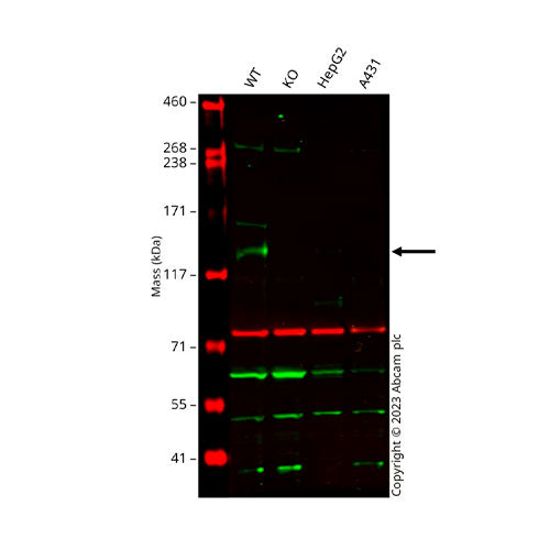 29512. RECOMBINANT ANTI-LDL RECEPTOR ANTIBODY (EP1553Y) 100UL ABCAM