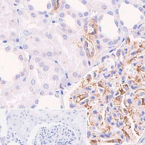 28809. RECOMBINANT ANTI-VEGFA ANTIBODY (EP1176Y)-C-TERMINAL 100UL ABCAM