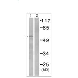 23893. ANTI-SMAD2 (PHOSPHO S467) ANTIBODY 100UG ABCAM