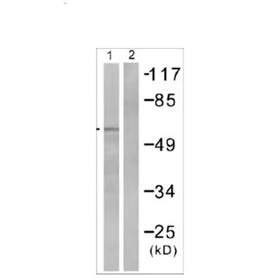 23893. ANTI-SMAD2 (PHOSPHO S467) ANTIBODY 100UG ABCAM