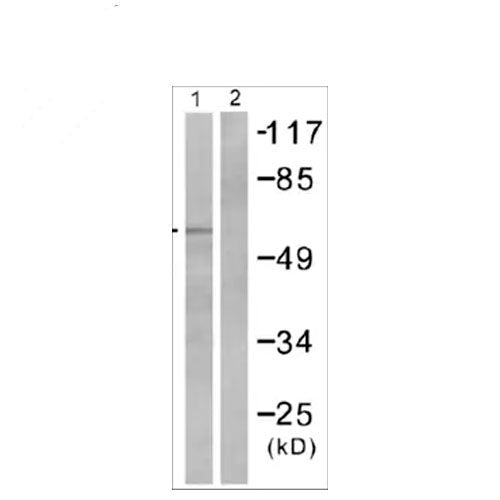 23893. ANTI-SMAD2 (PHOSPHO S467) ANTIBODY 100UG ABCAM