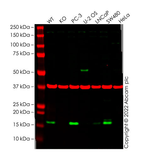 28810. ANTI-CLAUDIN 4 ANTIBODY 100UG ABCAM