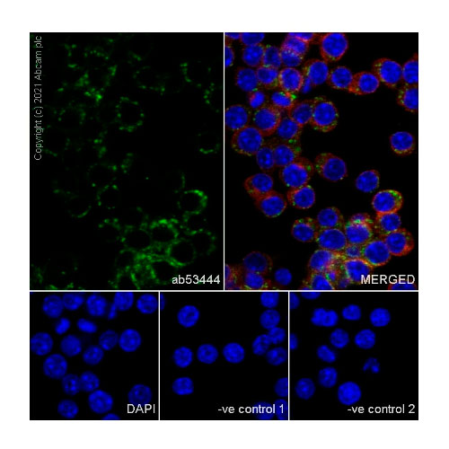 29905. RECOMBINANT ANTI-CD68 ANTIBODY (FA-11) 100UG ABCAM