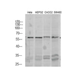 29514. ANTI-THYROID HORMONE RECEPTOR ALPHA ANTIBODY  100UG ABCAM