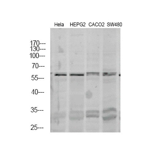 29514. ANTI-THYROID HORMONE RECEPTOR ALPHA ANTIBODY  100UG ABCAM