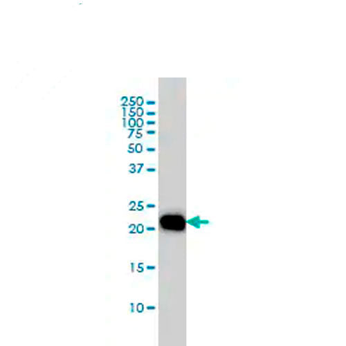 23895. ANTI-RHOA ANTIBODY (1B12) 100UG ABCAM