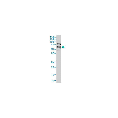 29516. ANTI-YAP1 ANTIBODY 100UG ABCAM