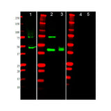 29901. ANTI-ALPHA SMOOTH MUSCLE ACTIN ANTIBODY 100UG ABCAM